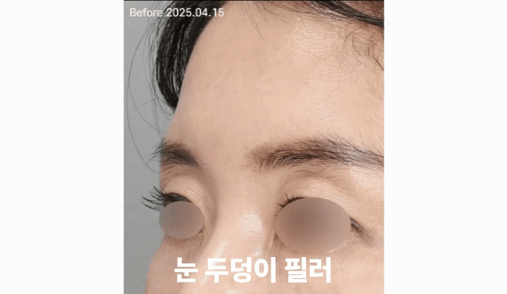 슬라이드3